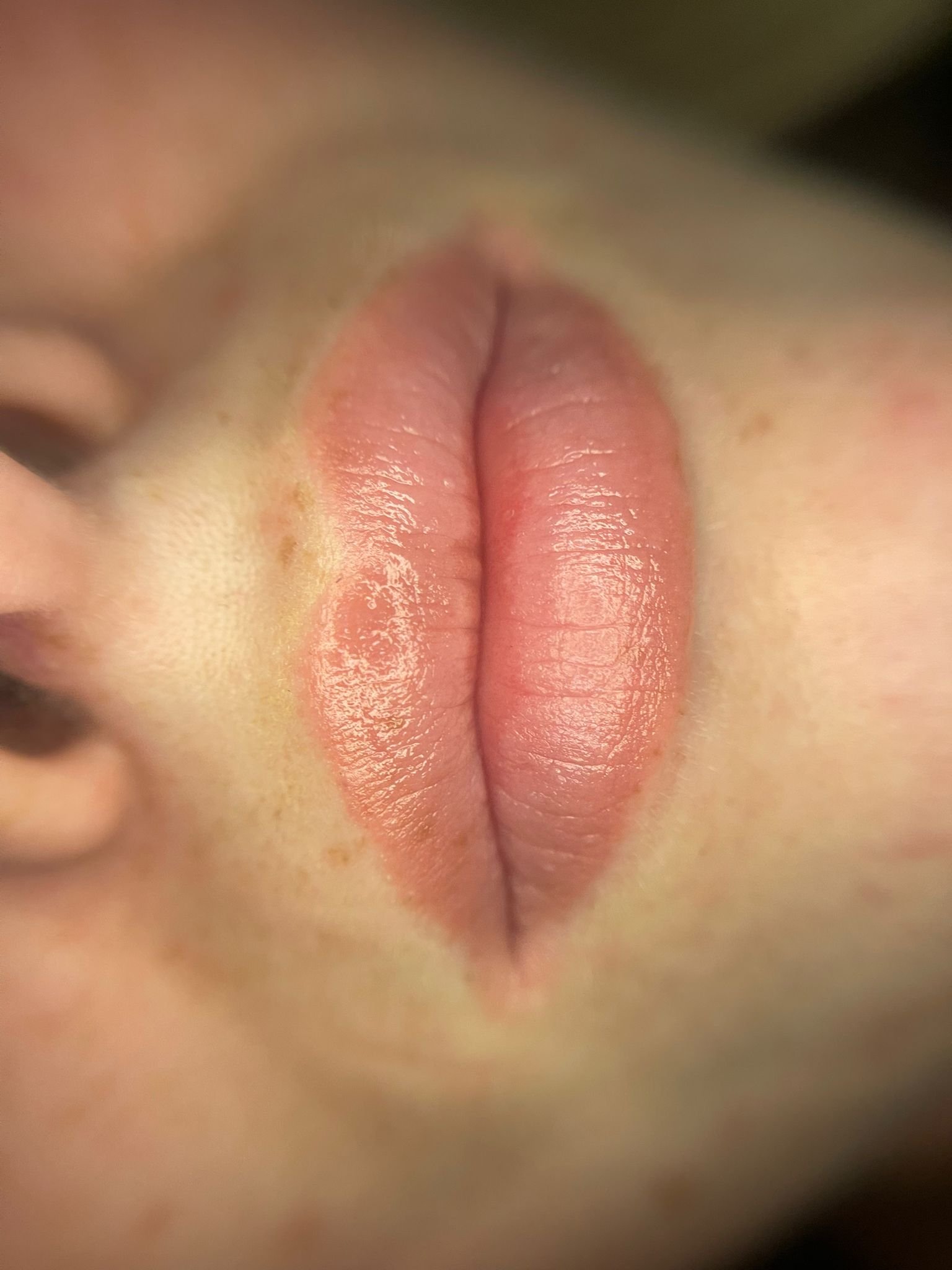 Lipblush resultaat 6